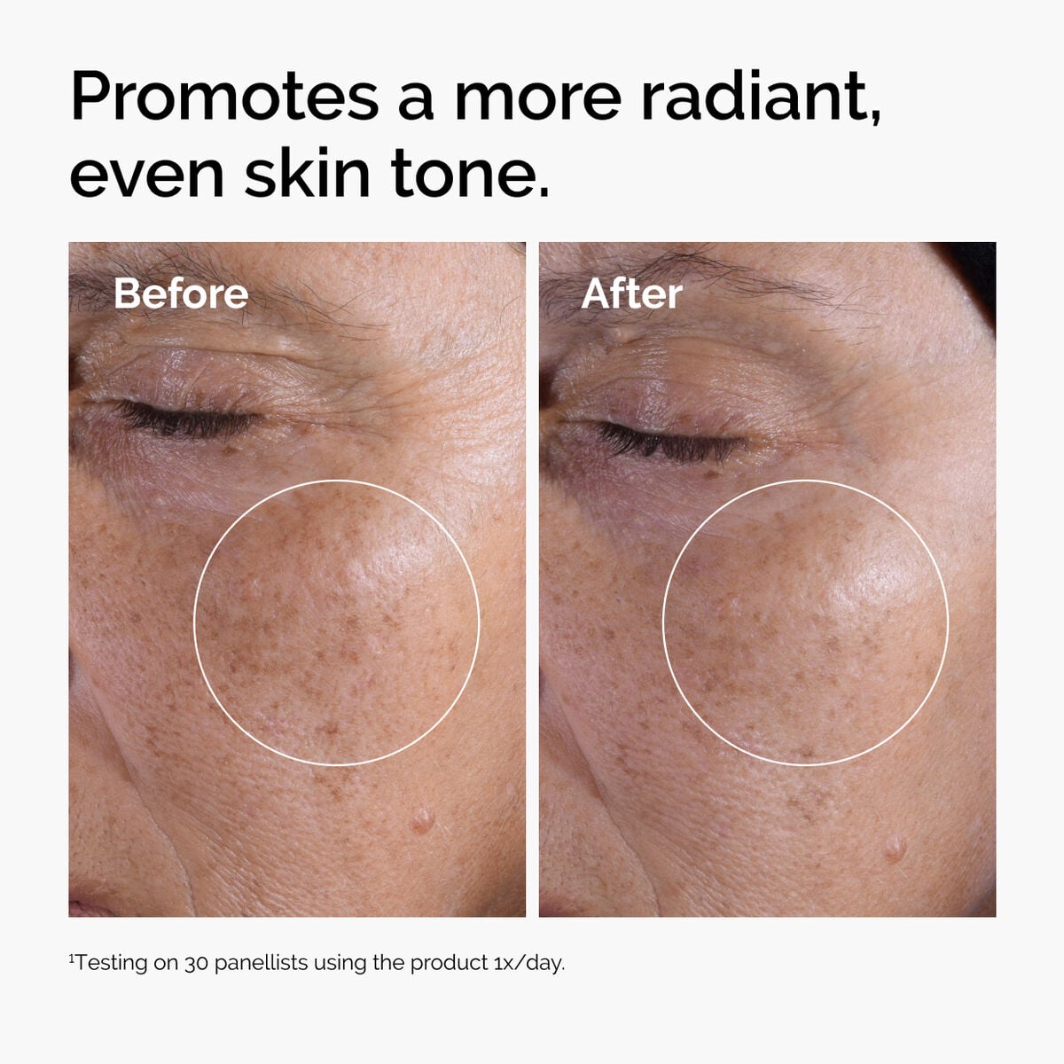glycolic-acid-7-exfoliating-toner-w0 ord-glycolic-before-after-radiance.jpg