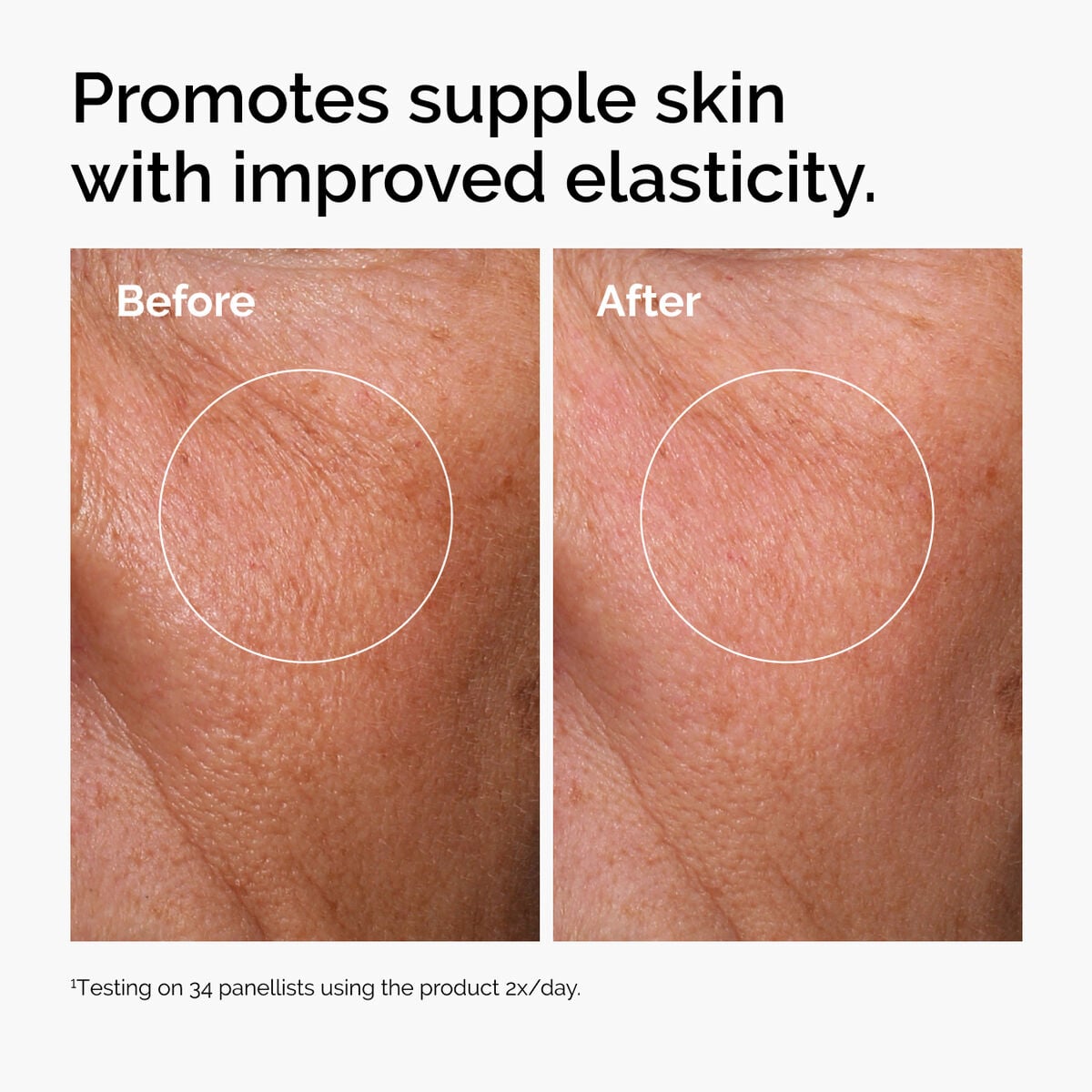 hyaluronic-acid-2-b5-with-ceramides-f0 ord-hyaluronic-acid-2pct-b5-hydrating-serum-before-after-elasticity.jpg