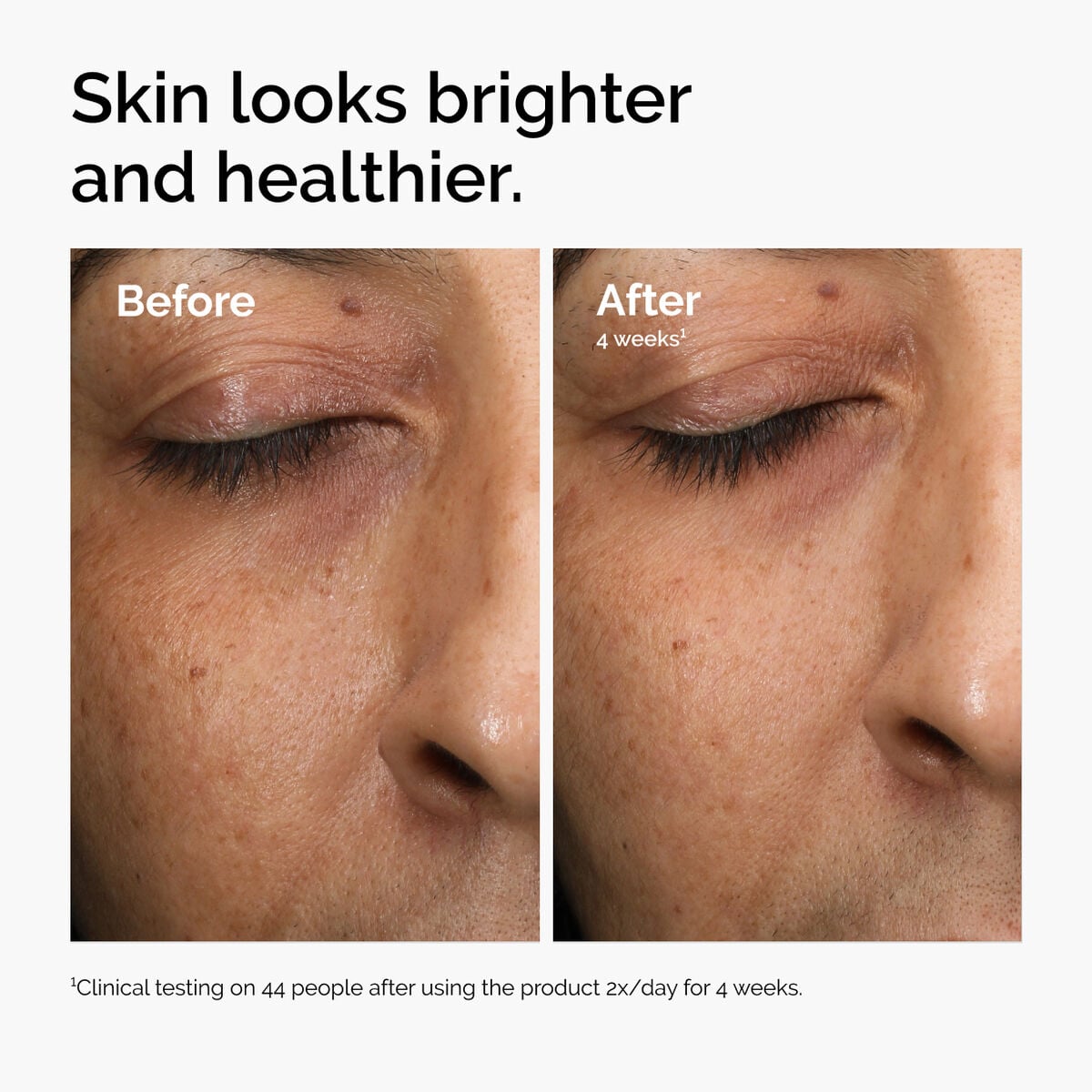 multi-antioxidant-radiance-serum-z9 ord-mars-before-after-healthy.jpg