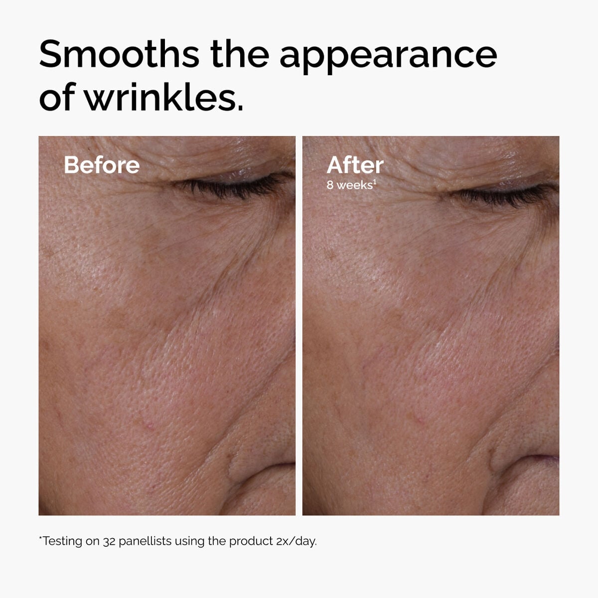 multi-peptide-ha-serum-j5 ord-multi-peptide-ha-serum-wrinkles-before-after.jpg